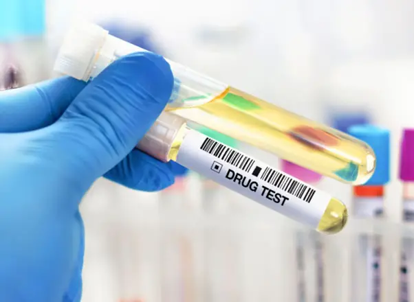 Uyuşturucu ve Alkol Testi
