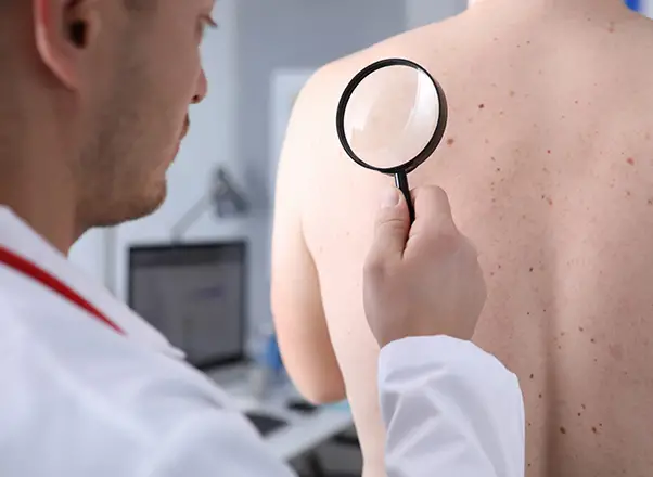 İşyerinde Cilt Kontrolleri